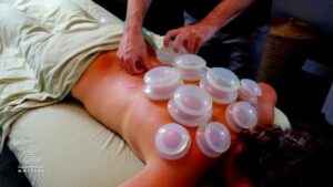Cupping Massage Essentials, 9CEs
