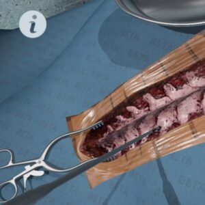 Massage Therapy for Surgical Procedures